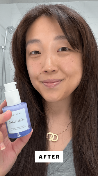 Allure contributing commerce writer Christa Joanna Lee after applying the Herbivore Botanicals DualRetinol Alternative...