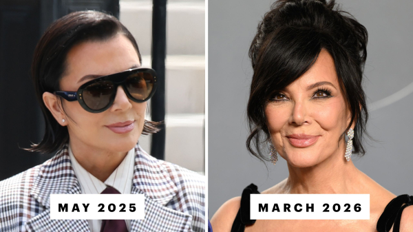 Is Kris Jenner’s Facelift Really Already “Slipping”?